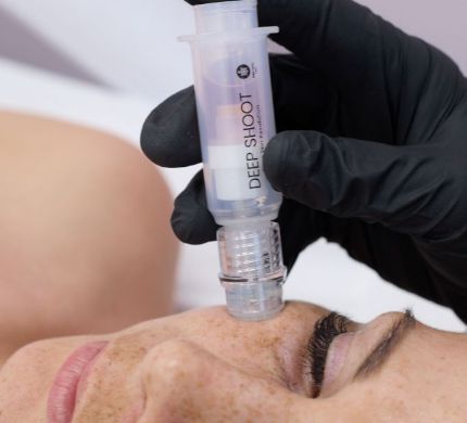 Intenzív skin booster kezelés a feszesebb, hidratáltabb és fiatalosabb bőrért.